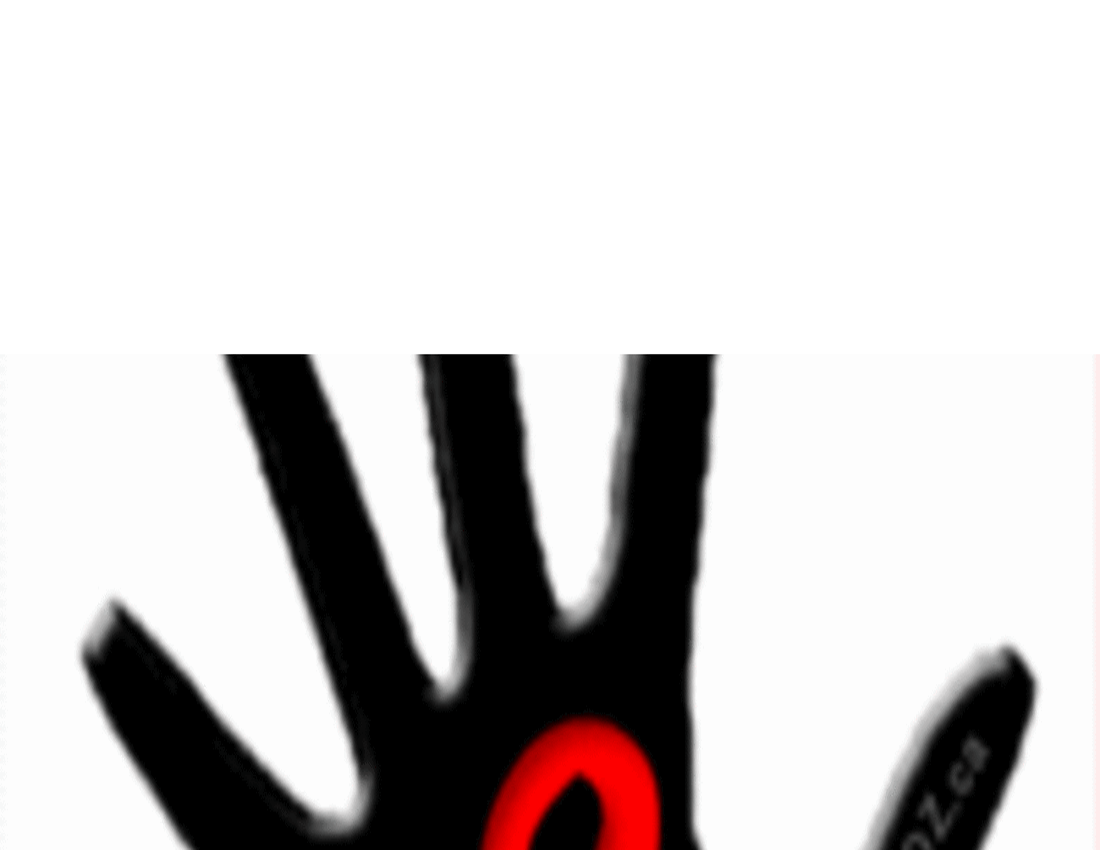 Днес е Международния ден в памет на жертвите от СПИН