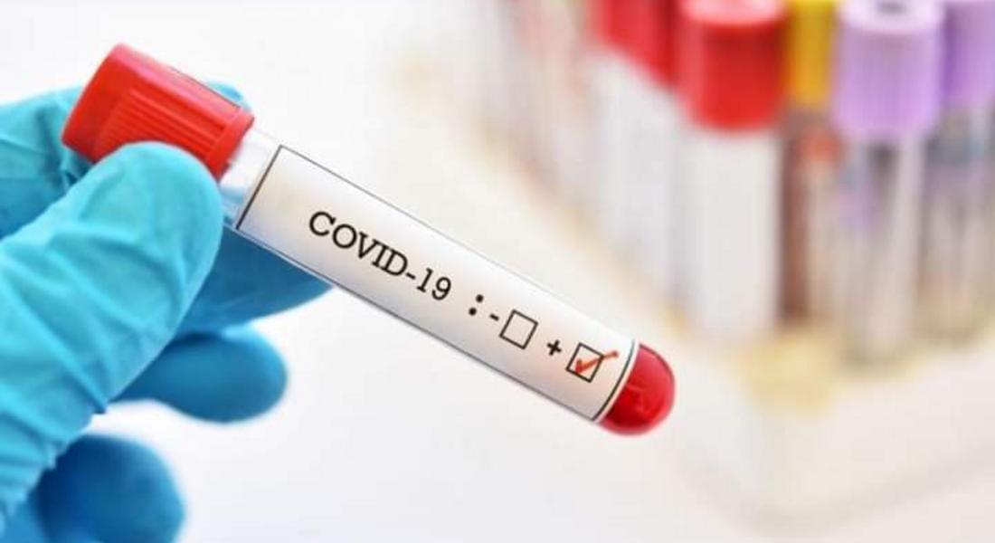Почти 7,5% положителни проби за COVID-19