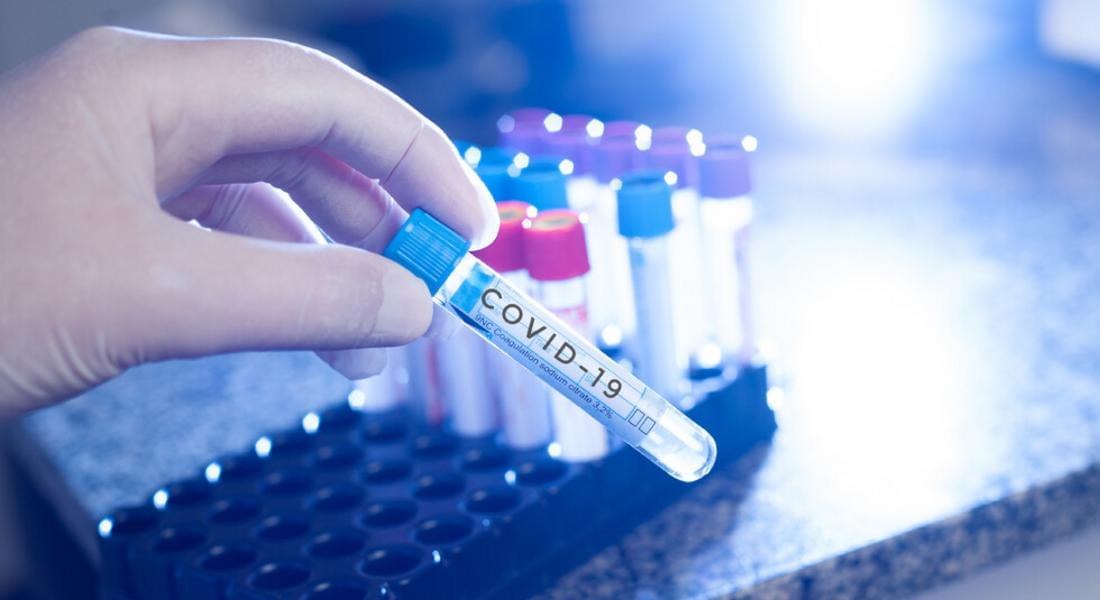  Намаление на случаите на СOVID -19 регистрират за поредна седмица в област Смолян