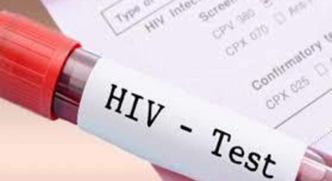 В РЗИ – Смолян изследват безплатно всеки желаещ по повод Европейската седмица за изследване за ХИВ и вирусни хепатити