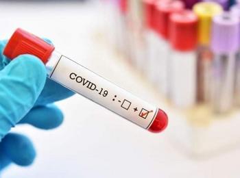 5643 нови случая на коронавирус, 154 души починаха
