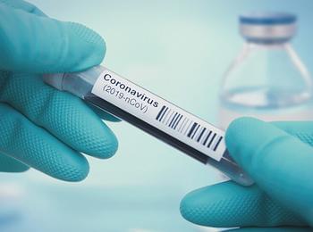 Само една лаборатория на територията на областта е оторизирана да извършва тестове за коронавирус