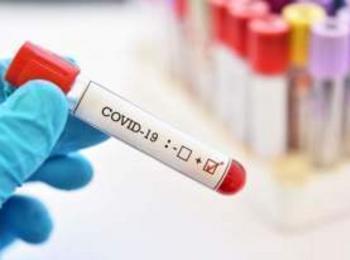 Четиринадесет нови случаи на КОВИД-19 в област