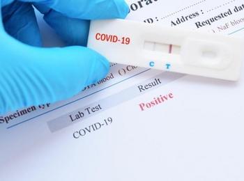 Рязък спад на новите случаи на коронавирус у нас, в Смолян един позитивен