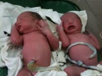 Родиха се близначета в МБАЛ-Смолян, едното с естествен възел на пъпната връв