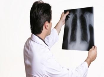 Два случая на туберколоза в Смолянско за седмица