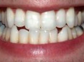 Безплатни прегледи на зъбите през октомври 
