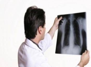 МБАЛ „Д-р Братан Шукеров“ организира  Седмица на безплатни прегледи за туберкулоза 