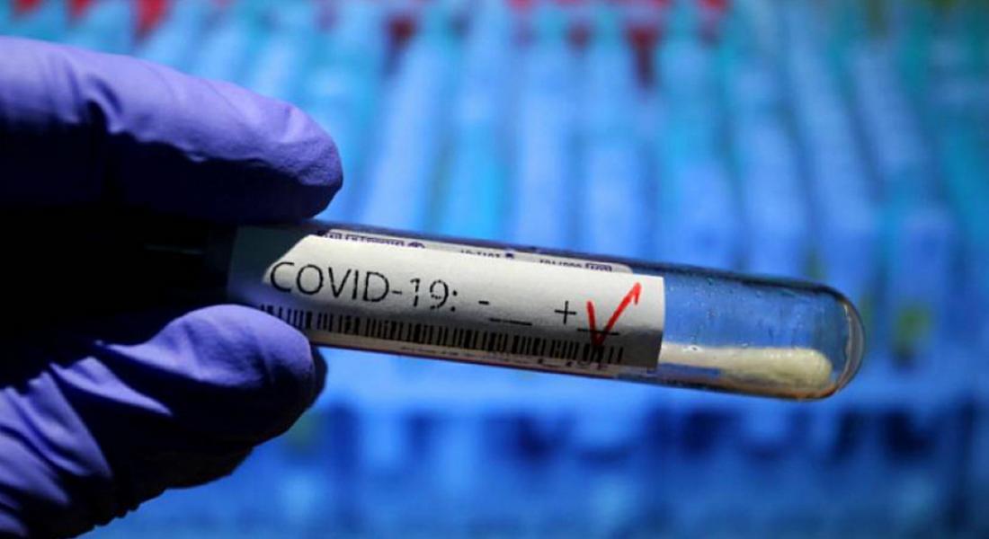  Всеки четвърти у нас е с COVID-19